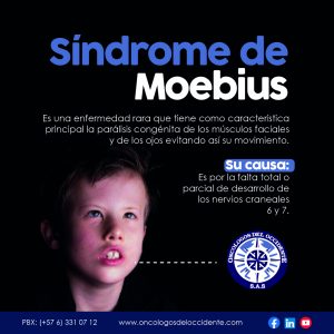 Síndrome de Moebius