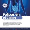 Pólipos en el Colon