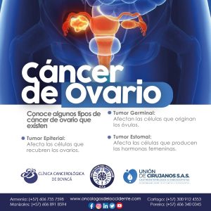 Conoce algunos tipos de cáncer de ovario que existen