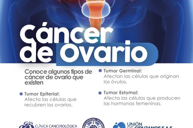 Conoce algunos tipos de cáncer de ovario que existen