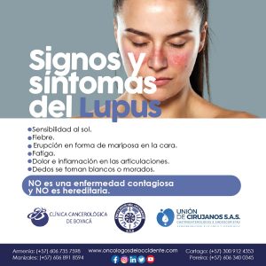Signos y síntomas del Lupus