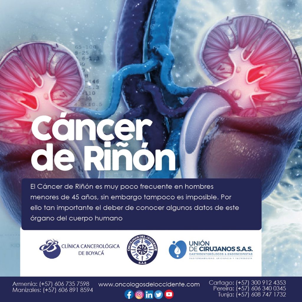 Riesgo de padecer Cáncer de Riñón • Oncólogos del Occidente S.A.S ...