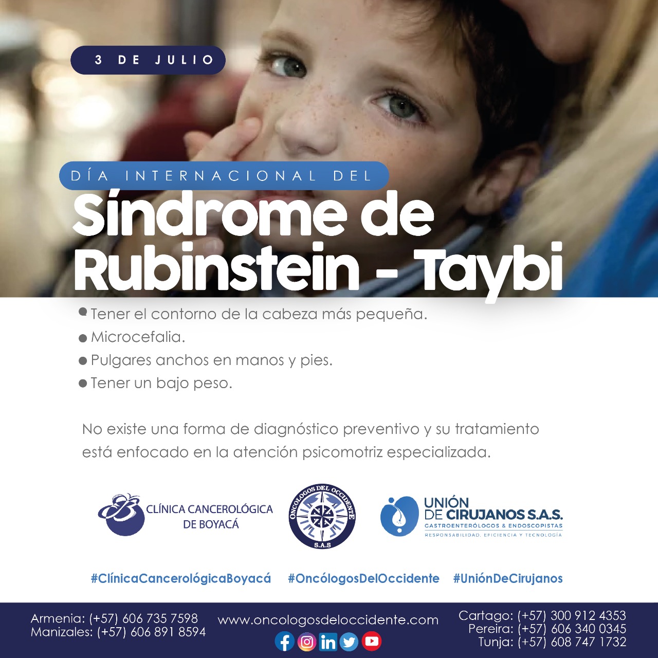 Día Internacional del Síndrome de Rubinstein-Taybi - 3 de julio Asociación  Española del Síndrome de Rubinstein-Taybi. (2020). 3 de julio - Día  Internacional del Síndrome de Rubinstein-Taybi (SRT). 03/07/2020, de FEDER  Sitio