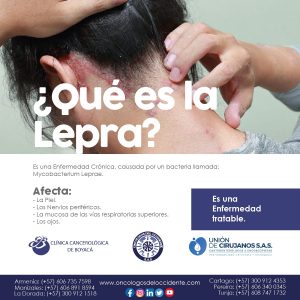 ¿Qué es la Lepra?