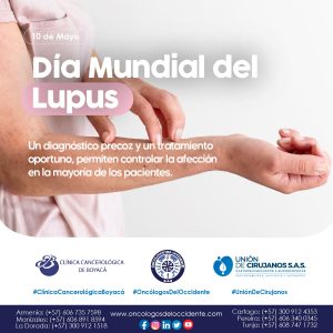 10 de Mayo. Día Mundial del Lupus