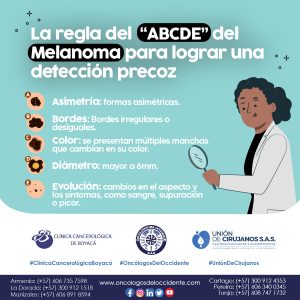 La regla del «ABCDE» del Melanoma para lograr una detección precoz