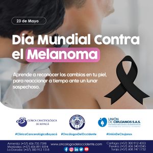23 de Mayo. Día Mundial Contra el Melanoma