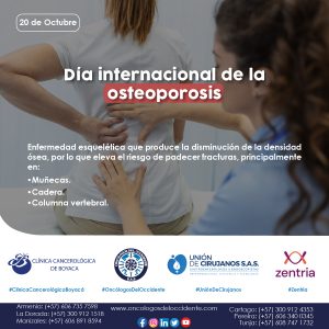 20 de Octubre. Día Internacional de la Osteoporosis